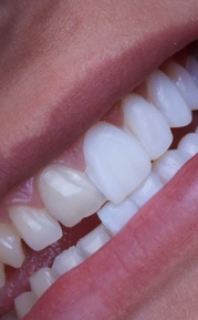 work